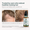 Growtica Hair Regrowth Serum 30ML